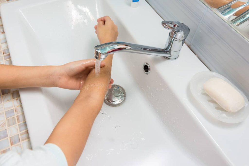 Wash a cricket bite with soap and water. 